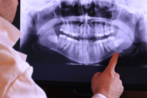 Best Emergency Denture Repair in Cumberland, WI